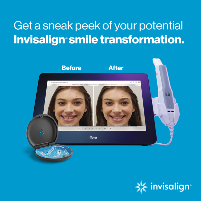 Life with Invisalign®: Eating, Speaking, and Living Comfortably with Clear Aligners